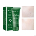 Sữa rửa mặt Breylee Acne Treatment Facial Cleanser