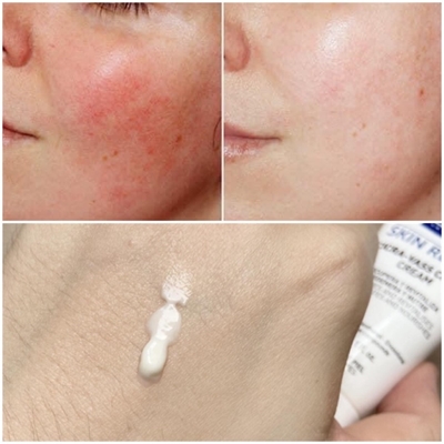 Kem Dưỡng MartiDerm Skin Repair Cicra Vass Cream