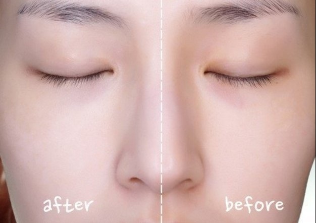 kem chống nắng Rogadis