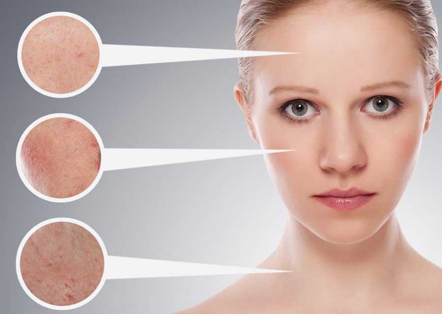 Không có nước tẩy trang thì dùng gì thay thế