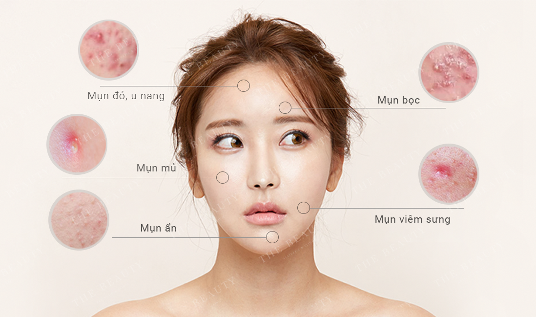 có nên dùng máy rửa mặt