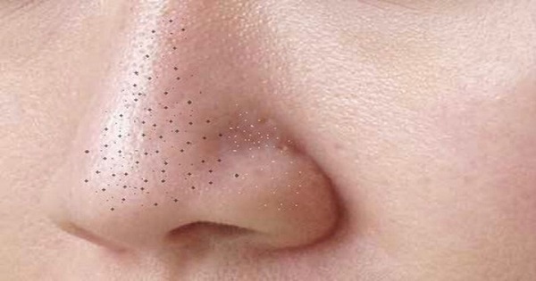 sữa rửa mặt cho da dầu mụn đầu đen lỗ chân lông to