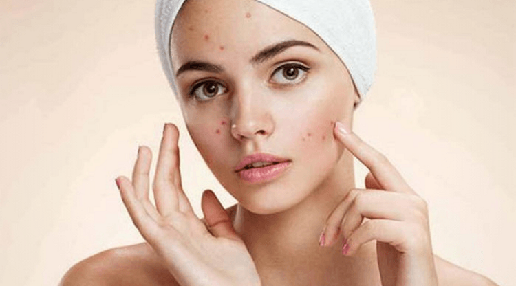 có nên dùng sữa rửa mặt