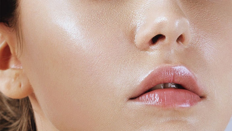 Da dầu, nhờn mụn có nên dùng kem dưỡng ẩm?
