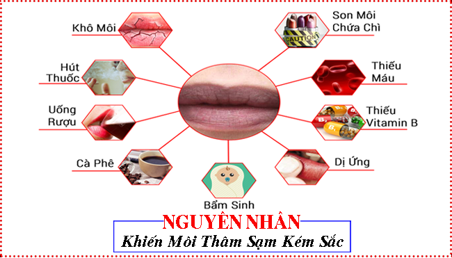 son dưỡng môi trị thâm