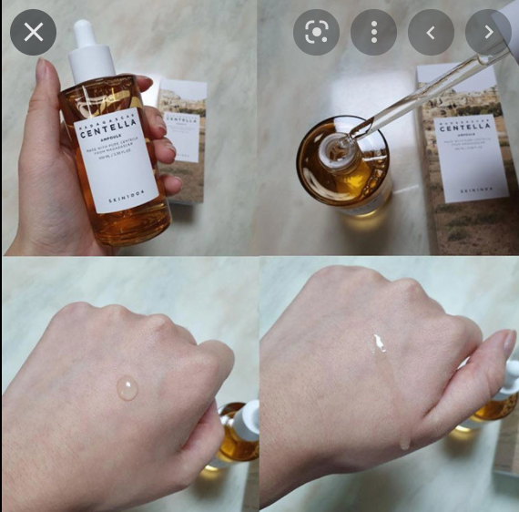 serum trị mụn cho da dầu