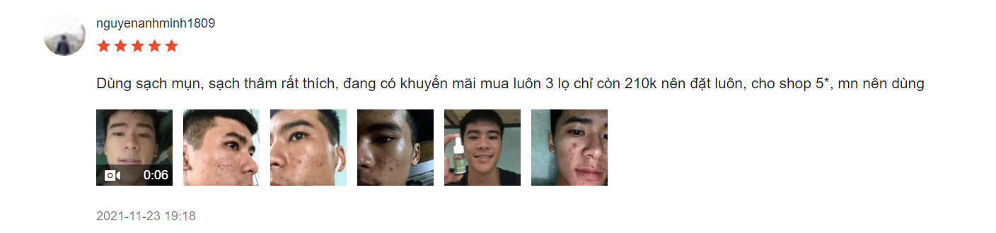 serum trị mụn diếp cá