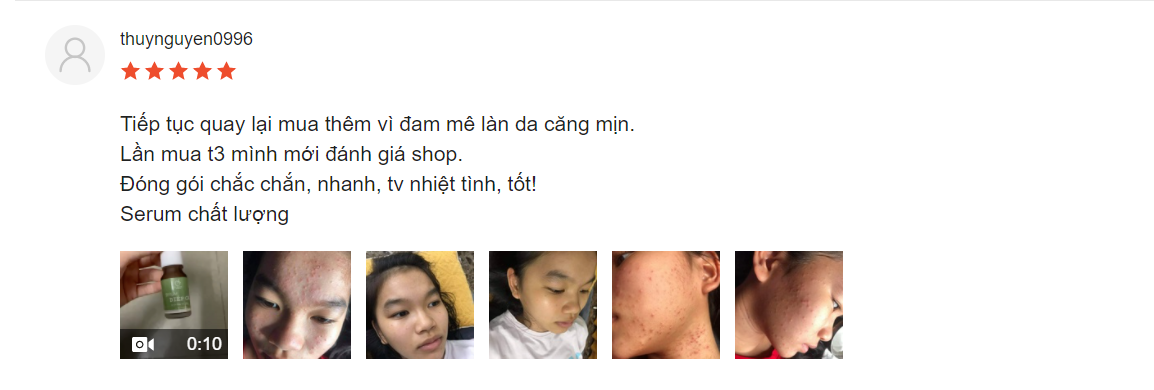 serum trị mụn diếp cá