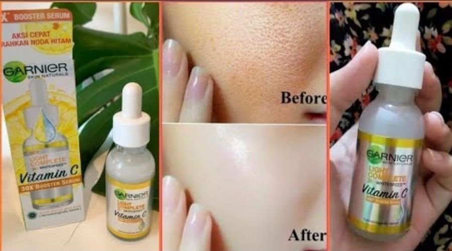 Công dụng của serum dưỡng trắng Garnier