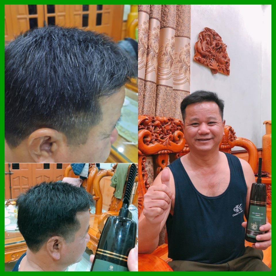 dầu gội phủ bạc laco